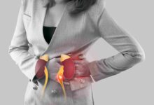 How to Managing the Kidney Stone Symptoms in Women for Better Health