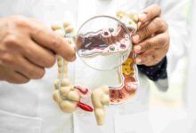 Are You 1 of 70 Million? How a Gut Health Supplement May Ease Digestive Issues