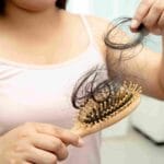 Can Diabetes Cause Hair Loss? 9 Unexpected Symptoms That Might Surprise You