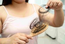 Can Diabetes Cause Hair Loss? 9 Unexpected Symptoms That Might Surprise You