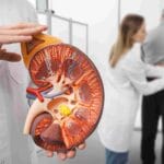 The 9 Unexpected Stages of Passing a Kidney Stone; #5 Will Shock You