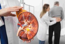 The 9 Unexpected Stages of Passing a Kidney Stone; #5 Will Shock You