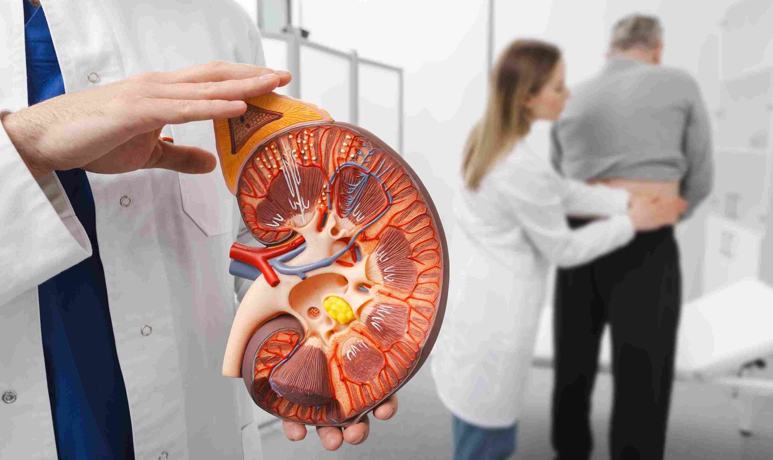 The 9 Unexpected Stages of Passing a Kidney Stone; #5 Will Shock You 1 Stages of passing a kidney stone